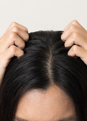 Woman scratching scalp