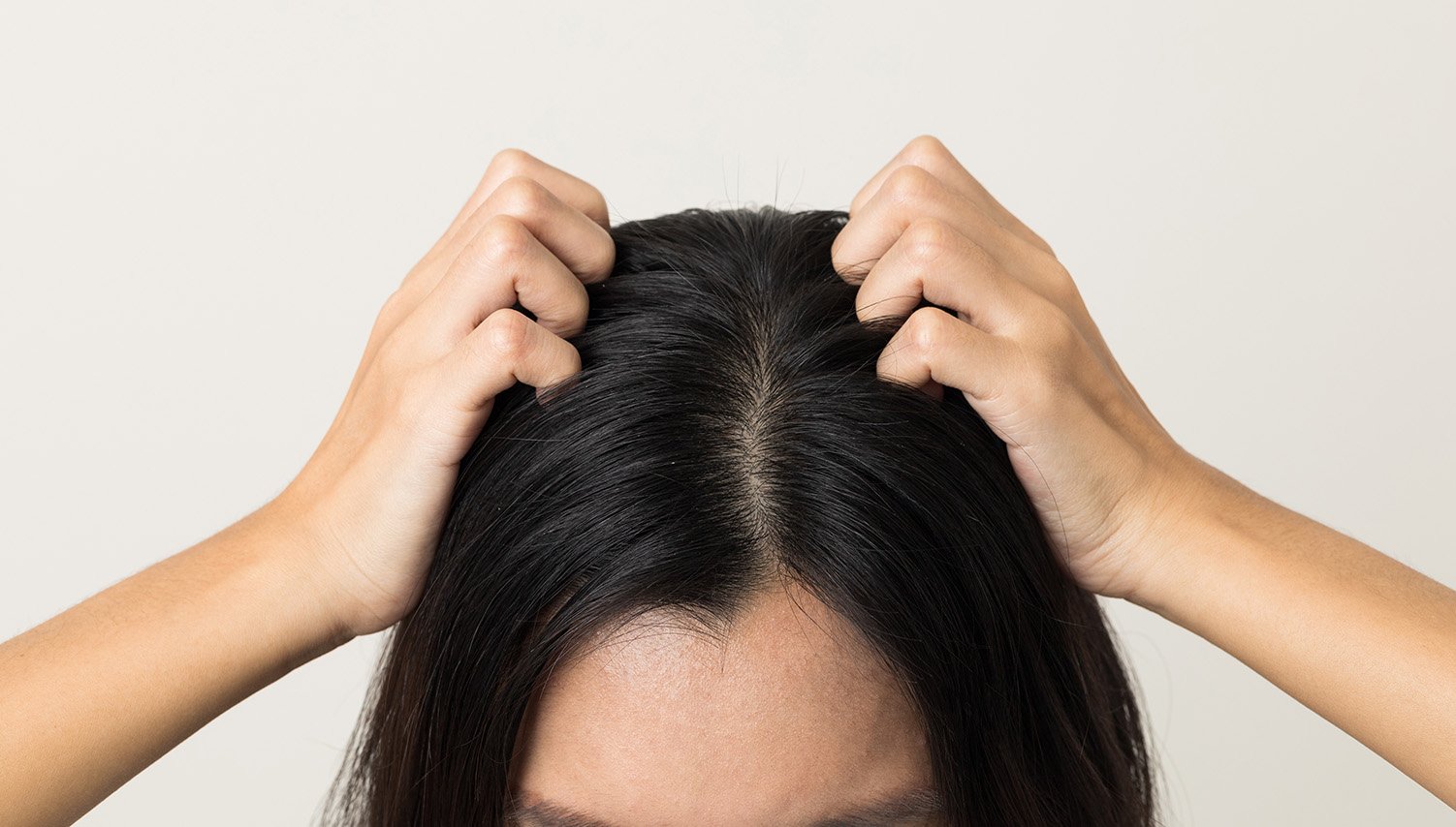 Woman scratching scalp